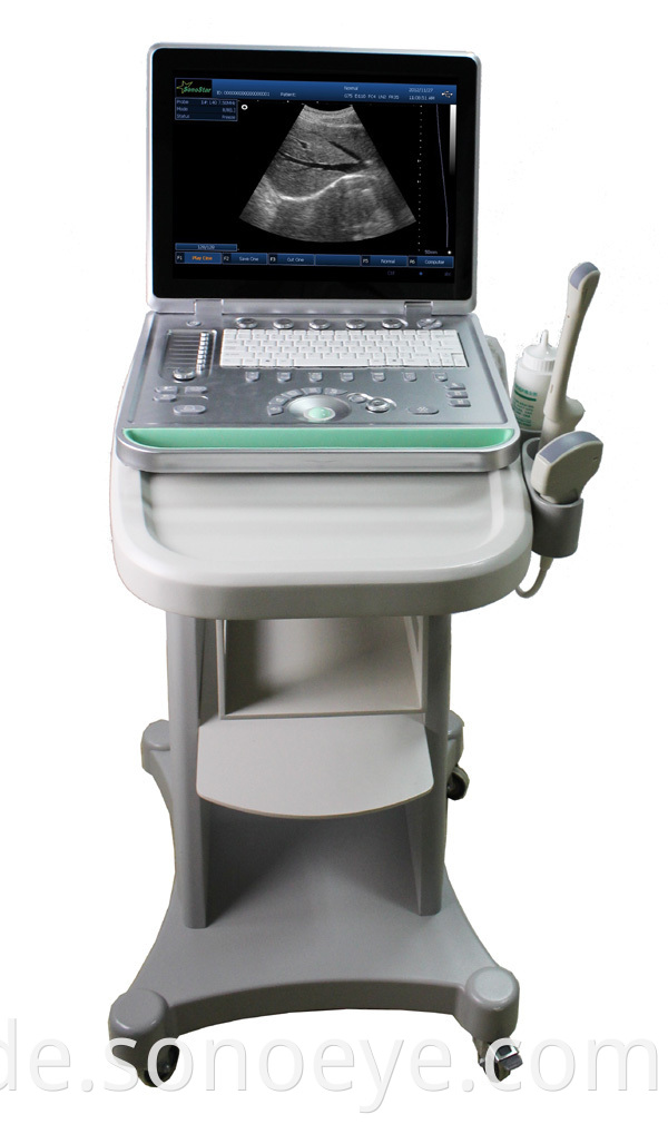 image for labtop ultrasound